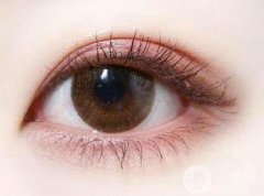 雙眼皮手術(shù)后多長(zhǎng)時(shí)間能恢復(fù)？