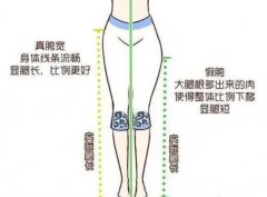 吸脂可以矯正假胯寬嗎？