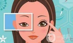 哪種雙眼皮需要修復(fù)？