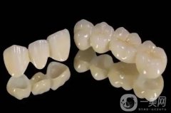 烤瓷牙應(yīng)該怎么選擇?