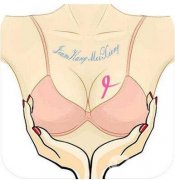 隆胸有可能得乳腺癌嗎？
