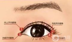 做外眼角會回縮嗎？會反彈嗎？應該怎么護理？