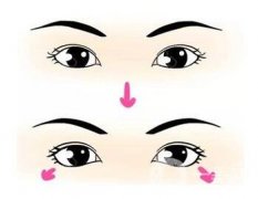 如何讓單眼皮變成雙眼皮？