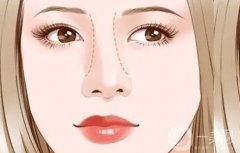 歪鼻子矯正手術有哪些禁忌癥？