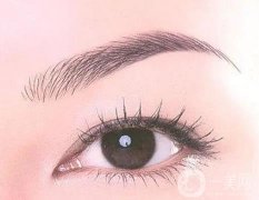 開眼角的傷疤多久會消失，有哪些需要注意?