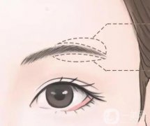 切眉后多久紋眉呢？術后應該怎么護理呢？