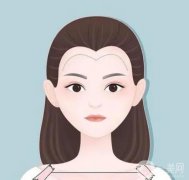 發(fā)際線植發(fā)是否靠譜？