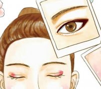 開眼角的疤痕消失時間怎么縮短?