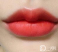 自體脂肪填充嘟嘟唇是*的嗎？