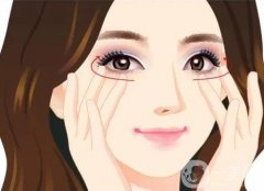 有哪些填充去除淚溝的方法?