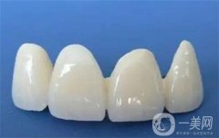 做烤瓷牙需要根管調(diào)節(jié)嗎，需要拔牙？