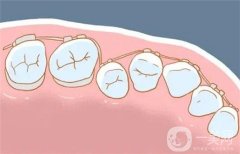 牙齒壞了一大半能修復(fù)嗎？