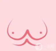 乳暈縮小術(shù)恢復(fù)需要多久？有哪些注意事項？