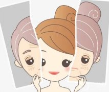 祛痘痘有哪些需要注意的事項呢?