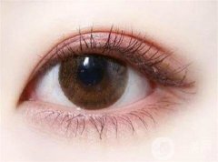 切開(kāi)雙眼皮的腫脹跟哪些因素有關(guān)？