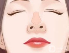 延長(zhǎng)鼻小柱有哪些后遺癥?