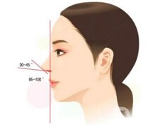 隆鼻后會(huì)腫多久，隆鼻材料對(duì)人體是否有傷害