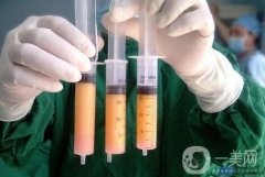 所有部位都能抽脂嗎？