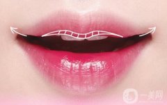 唇外翻矯正術(shù)切除縫合的方法是什么? 唇部外翻矯正后有哪些護理注意事項?