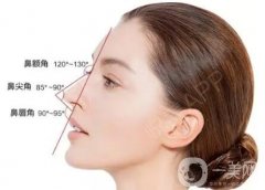 鼻小柱的理想形狀是什么?如何判斷自己是否有鼻小柱缺損?