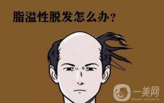 生姜能調(diào)節(jié)脂溢性脫發(fā)嗎?