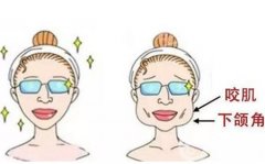 切骨容易有哪些副作用？