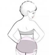 埋線減肥后多少天會(huì)瘦下來(lái)？