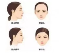 豐額頭什么方法好?