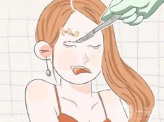 腫泡眼吸脂有什么副作用？