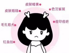 做了光子嫩膚后不能吃什么？