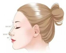 玻尿酸隆鼻的果與醫(yī)生的技術(shù)有關(guān)嗎？