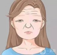 為什么會(huì)長(zhǎng)抬頭紋？抬頭紋是怎么形成的？