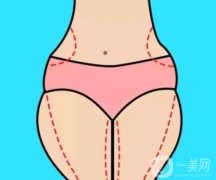 吸脂的誤區(qū)有哪些?