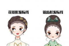 植發(fā)后還會(huì)掉嗎？植發(fā)后如何減少脫發(fā)？