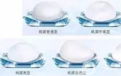 男性豐胸手術(shù)有哪些方法?