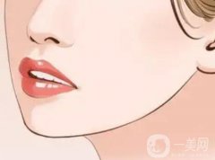 下頜骨吸脂術(shù)有什么優(yōu)勢？