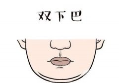 消除雙下巴目前有幾種方法?