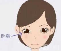 臥蠶需要注射多少玻尿酸？