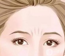如何消除抬頭紋?注意事項？