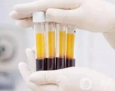 什么是，有什么作用