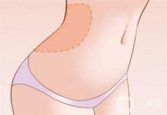 水動(dòng)力吸脂和普通吸脂有什么區(qū)別？