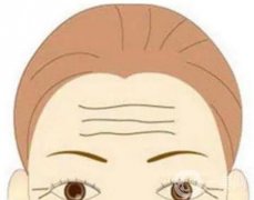 去抬頭紋有哪些方法？