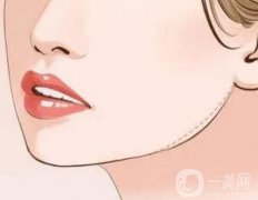 下頜骨增大術(shù)后果怎么樣？