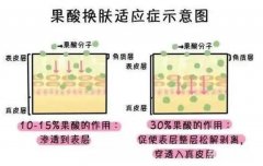 果酸換膚的危害有哪些？