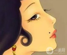 激光去痣多少錢？