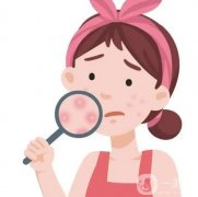 嚴(yán)重痤瘡怎么調(diào)節(jié)徹底?