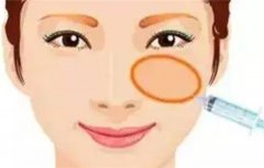 注射美容材料有哪些？