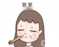 自體細(xì)胞注射除皺的優(yōu)勢(shì)?