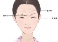 有哪些去除眉間皺紋的方法？