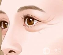 眼部除皺手術(shù)主要有哪些，特點(diǎn)是什么